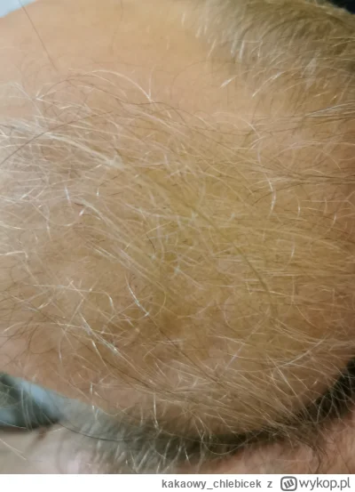 kakaowy_chlebicek - Czy z taką fryzurą mam szansę znaleźć dziewczynę? #przegryw