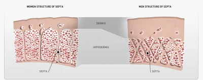 Wrrronika - Uwaga, tak, też mam cellulit xD

Ciekawostka, której się teraz dowiedział...