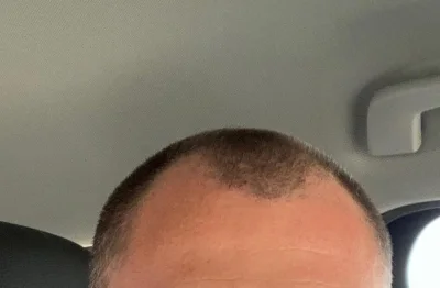 i.....a - Czy z takimi zakolami mam szansę zostać kierowcą ciężarówki? 
#pytaniedoeks...