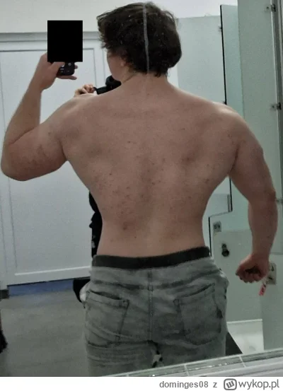 dominges08 - plec
#mikrokoksy