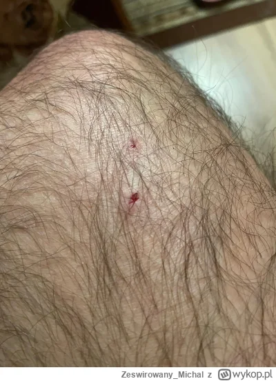 Zeswirowany_Michal - ZBRODNIA
SPOILER