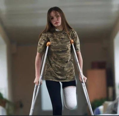 Kumpel19 - 19-latka Ruslana Danilkina dwa tygodnie temu straciła nogę w rosyjskim ost...