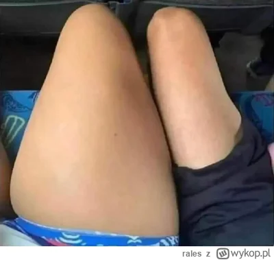 rales - #grubaimanlet