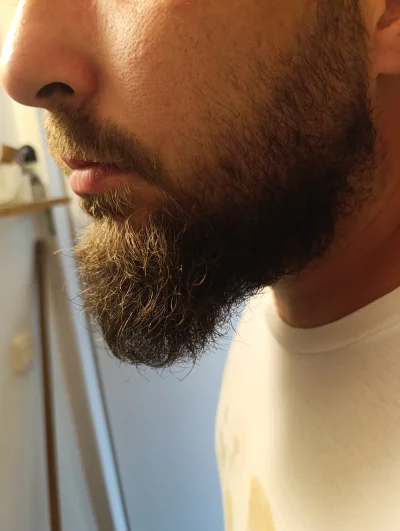 ryoku88 - #przegryw zarost do oceny, całe szczęście rośnie i zasłania birdcelizm