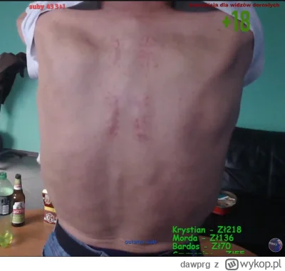 dawprg - #bystrzaktv poskładane plecy kaczora