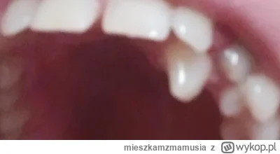 mieszkamzmamusia - #zeby #dentysta #stomatologia #zdrowie

Od kilku lat mam takiego d...