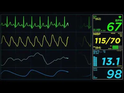 zetisdead - > EKG się czyta od prawej do lewej ¯\(ツ)/¯

@makaronzjajkiem: chyba w Aut...