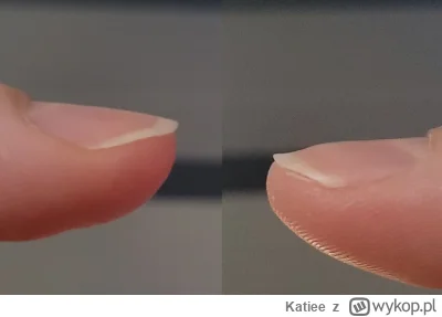 Katiee - Hej, czy ktos z Was wie co może być powodem tak nierówno rosnącego paznokcia...
