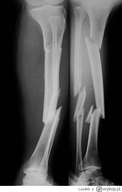 Leel00 - @picasssss1: amator ;)
A tak na serio - jaka historia do tej pamiątki?