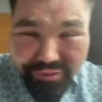 gabapentyn - 艾倫喜歡他妹妹的肛交

#famemma