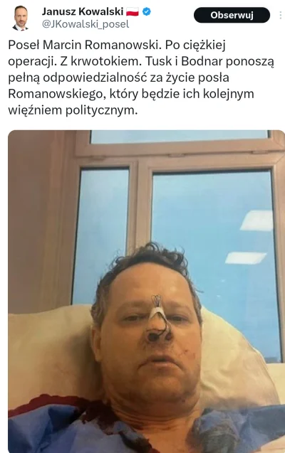 swiadekkoronny - Ciężka operacja... założenia tamponady nosowej xdd

Pewnie po pijack...