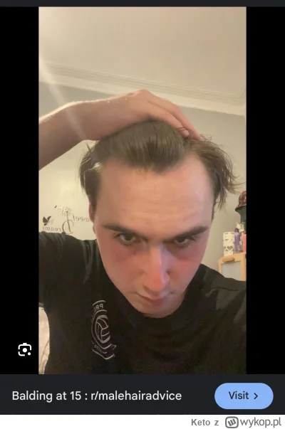 Keto - @Pasterz30 xd