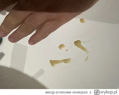 wargi-sromowe-mniejsze - O takie wydmuchałem tam głęboko z głowy z zatok.
Na zdjęciu ...