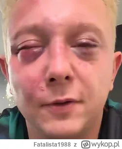 Fatalista1988 - Kochani małe pytanko jakie ciśnienie ustawianie na swoich pompkach do...