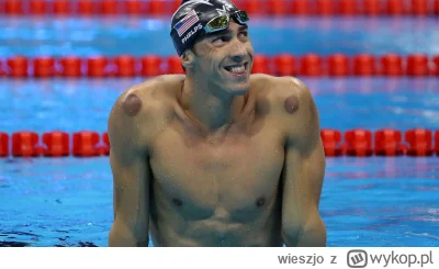 w.....o - @tracz_here: Bańki miał robione d
