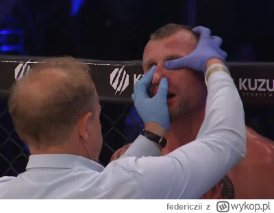 federiczii - #famemma #primemma Złamany nos w Fame = koniec kariery, zbiórki na zrzut...