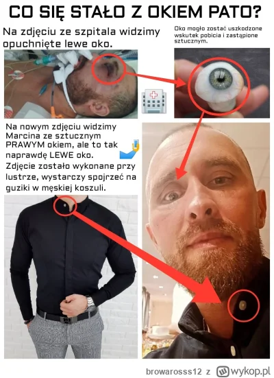 browarosss12 - @vulcanitu: A były takie podśmiechujki, że ma szklane oko teraz, do te...