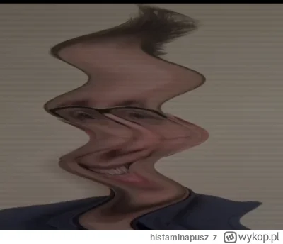 histaminapusz - #sebcel ( ͡° ͜ʖ ͡°)