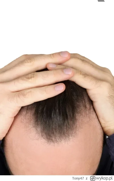 Tony47 - #przegryw #logikaniebieskichpaskow #bieganie #spierdotrip

Odkąd huop otrzym...