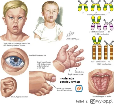tellet - @b0dyload: Ah, bo pewno nie widziałeś nowych oznak znanego schorzenia