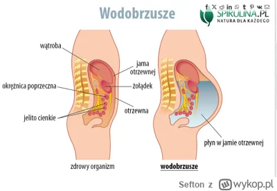 Sefton - >@Vendigoo Widziałeś jego brzuch? Śmierć głodowa mu nie grozi. Ma zapasy na ...