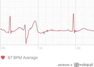 zackson - co oznacza ten spadek w EKG? Wiem, że mierzenie zegarkiem nie jest idealne,...