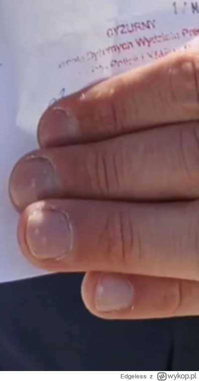 Edgeless - https://wykop.pl/ludzie/LM317K zdjęcie moje wpis ciao! 25.02.2025 do dziś
...