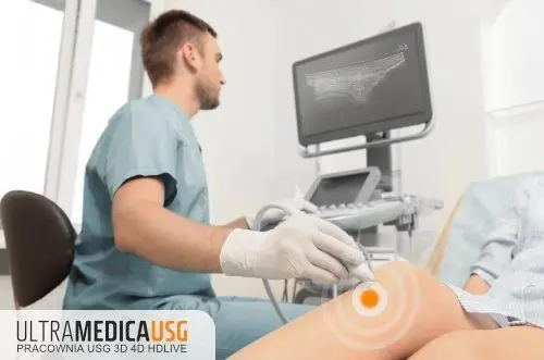 pyszniarz - @Primek_1980: kolanoskopie nie robi się z narkozą - nawet dziecią dają be...