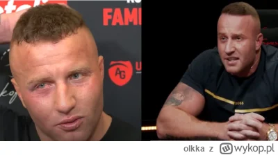 olkka - Nie bierzcie sterydów bez opamiętania bo skończycie jak Denis. #famemma