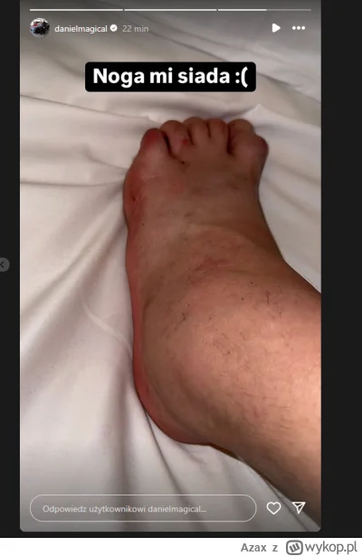 Azax - Tucznik ma rozwalone kopyto XD złamany palec złamana noga stulejka dwa lata na...