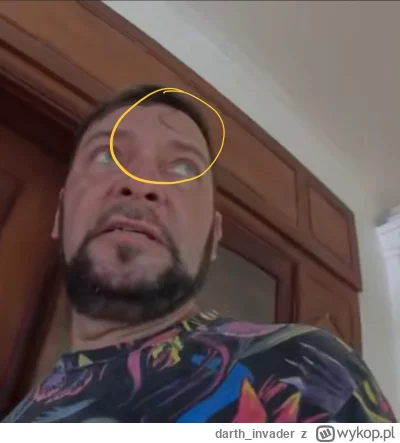 darth_invader - Koncepcjusz z Wyszkowa znowu się wywalił po pijaku na motorze?
#rapor...