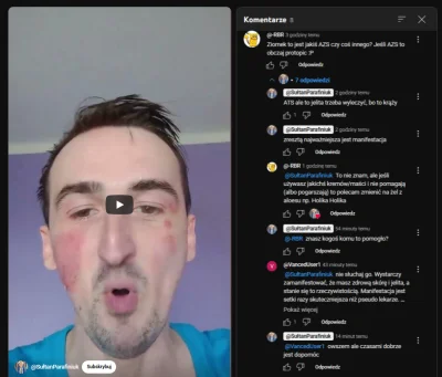 Tippler - @lab_rat Wyhodował własny ekosystem na twarzy. Jedynie tyle wiem, co tutaj ...