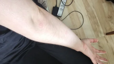 Chumbala - @Chumbala: