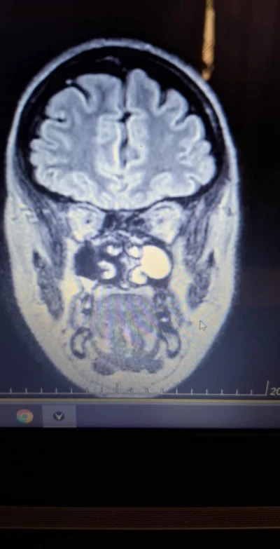 Snusmumriken_ - Hej mirki z #medycyna #lekarz mam już pisać testament? XD Miałam dzis...