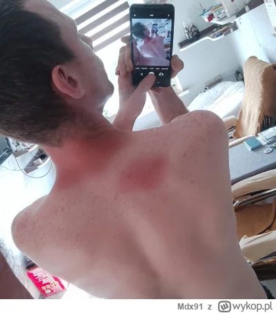 Mdx91 - Dzisiaj w robocie (na dachu) mialem koszulke "na wykonczeniu" z dziura przy k...