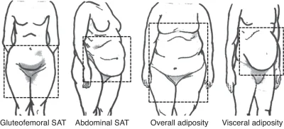 n3ssunostaguardando - @Vedar: jak nadwaga jest jak po lewej, to jest dobrze
jak na pr...