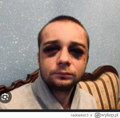 radoskor3 - @BezDobry a później ała to tylko żart ( ͡º ͜ʖ͡º)