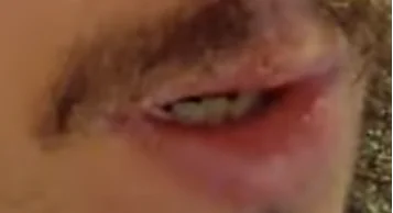 WodaPitnaJest - jak myślicie od czego cebe debe ma opryszczkę?
#raportzpanstwasrodka