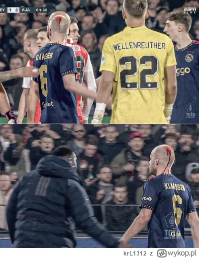 krL1312 - @Tr1ckshot: podobno zapalniczki