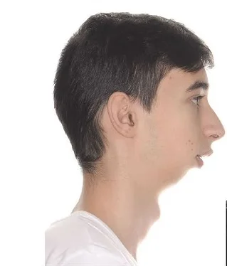 Tippler - Ja katar mam cały rok, tylko w zimie większy i tak oddycham przez te usta, ...