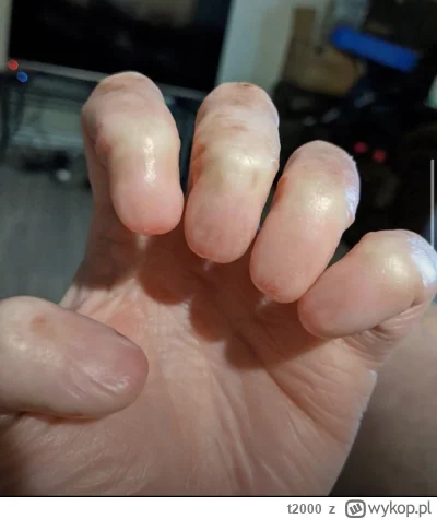 t2000 - Jakby się ktoś zastanawiał to jest taka wada rozwojowa przez którą ludzie rod...