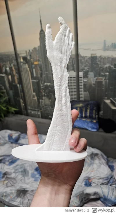 hanys1dwa3 - #f1 dla jego bolesnej renki