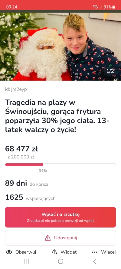 kre-dens - To jest sensowna zbiórka, a nie dla Was szczury!
https://zrzutka.pl/jm2eyp...