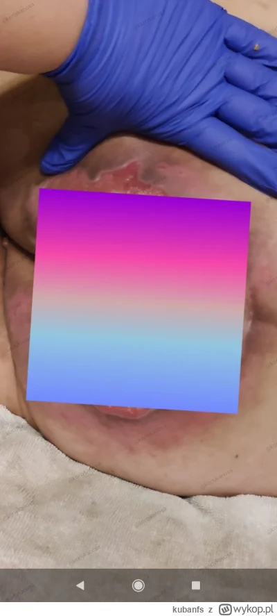 kubanfs - #kononowicz powiem wam że bez cenZury jest grubo z odleżyna knurowicza tuta...