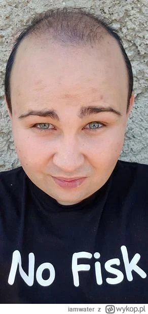 i.....r - #famemma sigma @Nicolaus_Steno1 jak to zrobiles ze tupecik ci nie spadl na ...