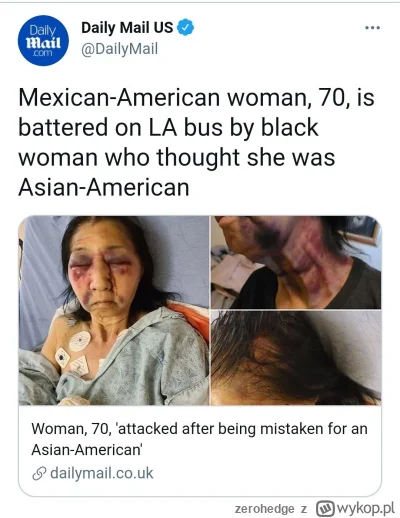 zerohedge - @Icouldbeyourmom: nie była statystycznie świadom zagrożenia z powodu  pro...