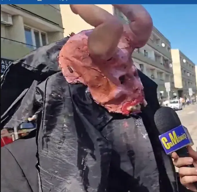 Robson86pn - Oni są się tylko spotykać w szpitalach, szkoda że nie psychiatrycznych. ...