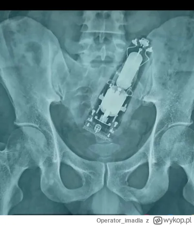 Operator_imadla - Kurde po pijaku połknąłem maszynkę do golenia, co ja powiem na Sorz...