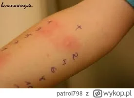 patrol798 - @mateuszdinozaur test skórny u alergologa. Nakłuwają ci skórę i w tym mie...