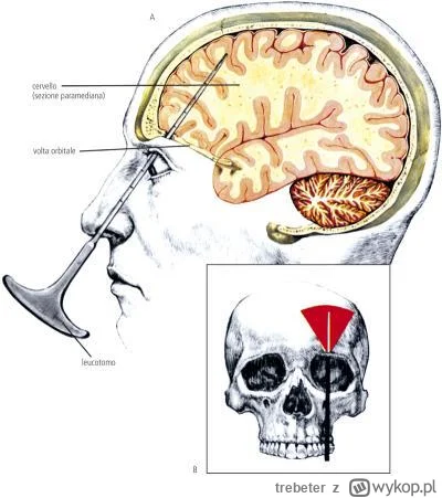 trebeter - @4pietrowydrapaczchmur: